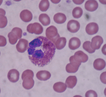 Image: Microscope image (400x) of a peripheral blood smear showing an eosinophil surrounded by erythrocytes (Photo courtesy of Wikimedia Commons).